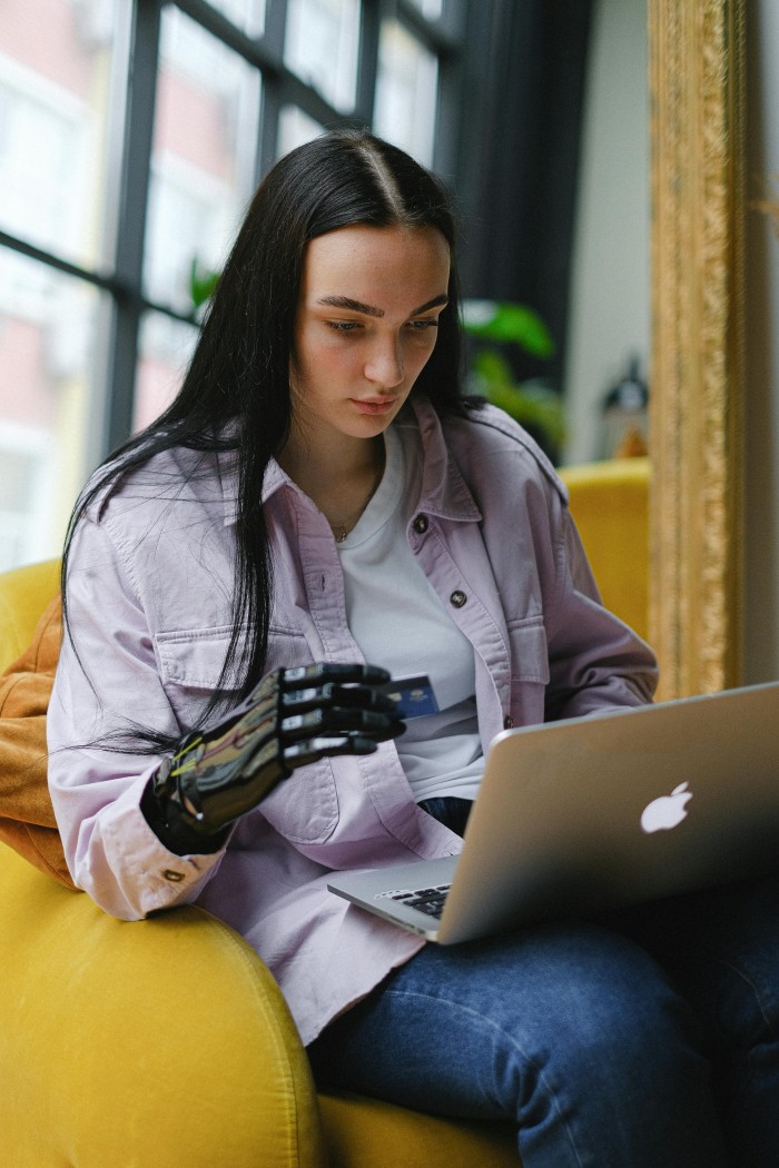 A woman with a bionic hand is sitting on a coach using a laptop to shop online.